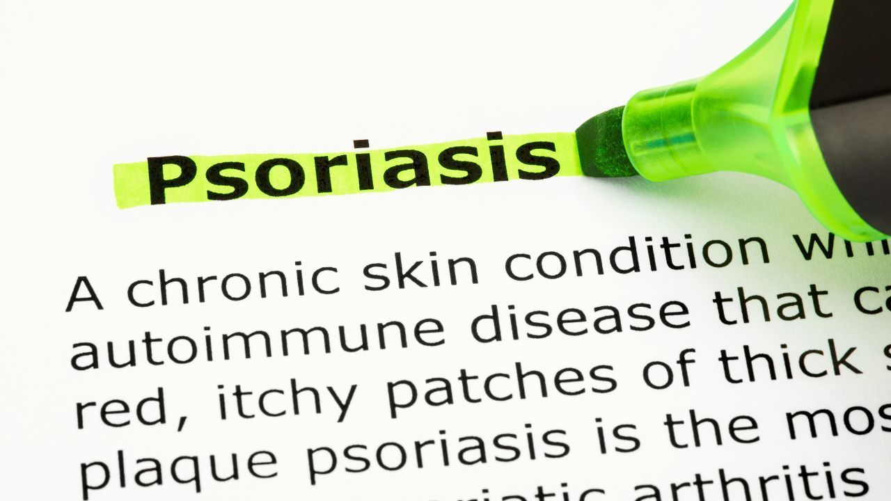 Psoriasis: cómo elaborar una crema magistral de fluocinolona acetónido y ácido salicílico 