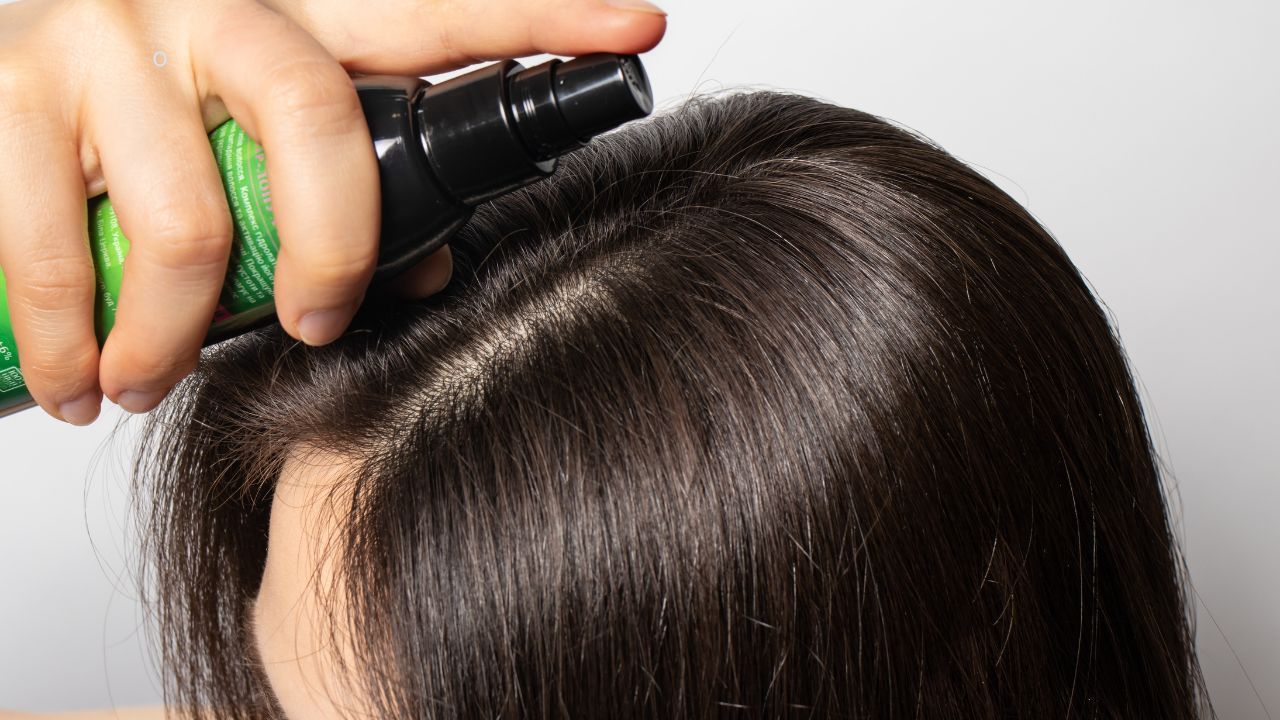 Solución alopecia androgénica con Minoxidil y Finasteride sin Propilenglicol
