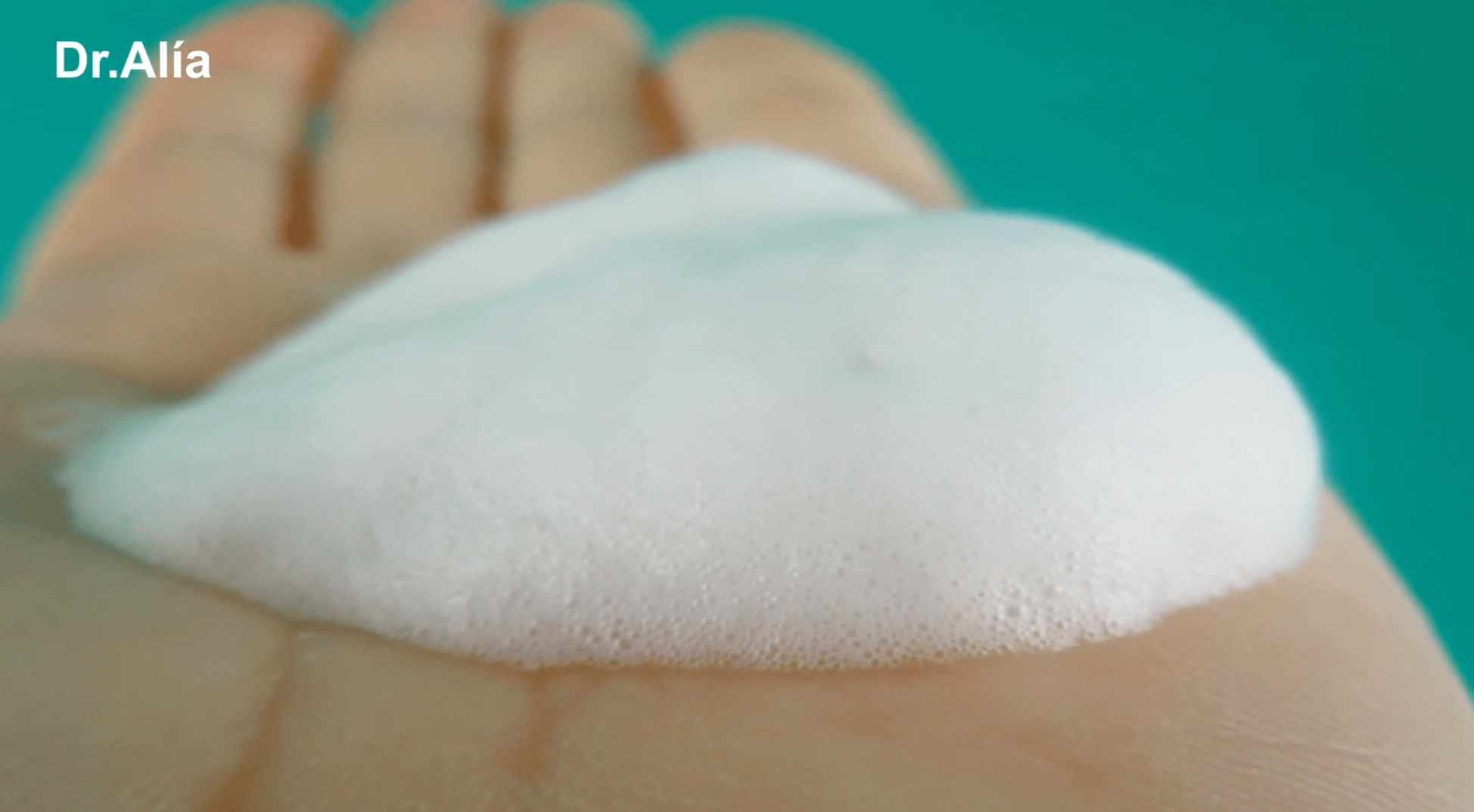espuma de minoxidil